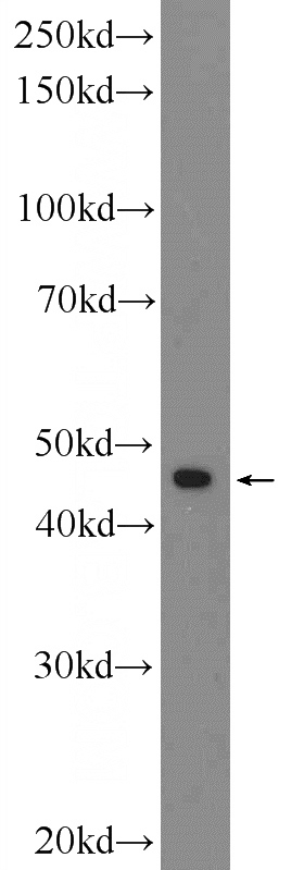 MCF-7 cells were subjected to SDS PAGE followed by western blot with Catalog No:108172(ARRDC3 Antibody) at dilution of 1:600
