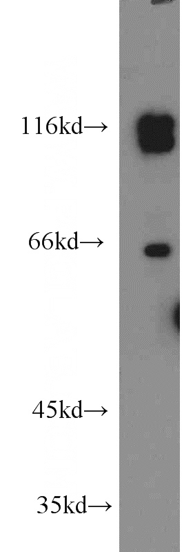 Y79 cells were subjected to SDS PAGE followed by western blot with Catalog No:114233(PRPF40B antibody) at dilution of 1:1000
