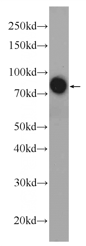 human blood tissue were subjected to SDS PAGE followed by western blot with Catalog No:107910(AFM Antibody) at dilution of 1:2000