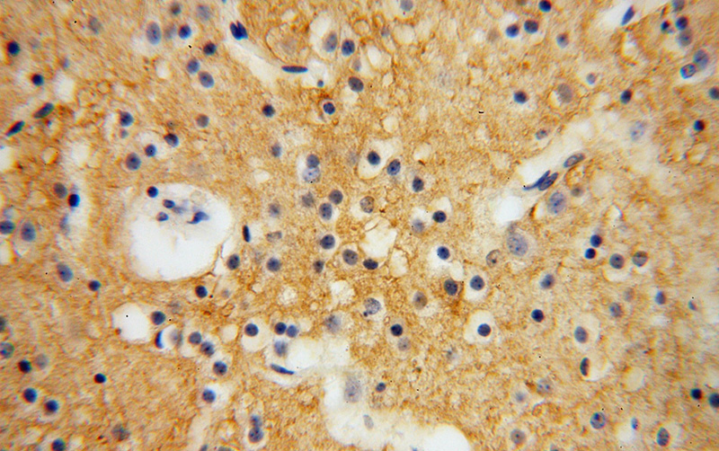 Immunohistochemical of paraffin-embedded human brain using Catalog No:113695(PCDHA5 antibody) at dilution of 1:100 (under 40x lens)