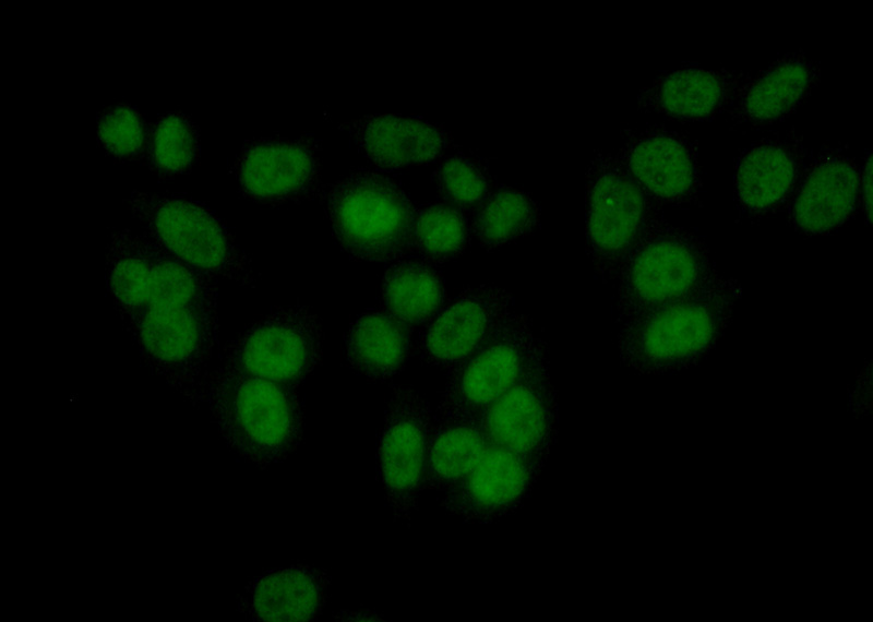 Immunofluorescent analysis of (10% Formaldehyde) fixed HeLa cells using Catalog No:114519(RAD9A Antibody) at dilution of 1:50 and Alexa Fluor 488-congugated AffiniPure Goat Anti-Rabbit IgG(H+L)