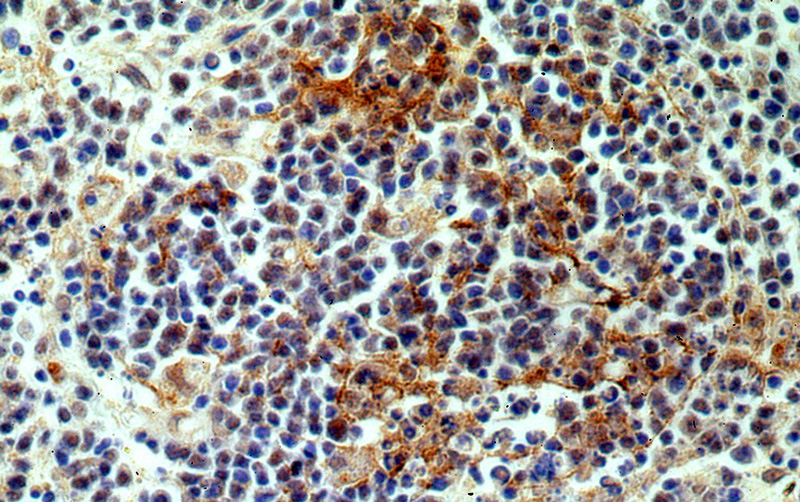 Immunohistochemical of paraffin-embedded human spleen using Catalog No:113201(NKTR antibody) at dilution of 1:100 (under 40x lens)
