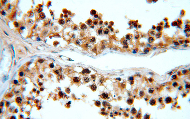 Immunohistochemical of paraffin-embedded human testis using Catalog No:110882(GATA4-Specific antibody) at dilution of 1:50 (under 40x lens)