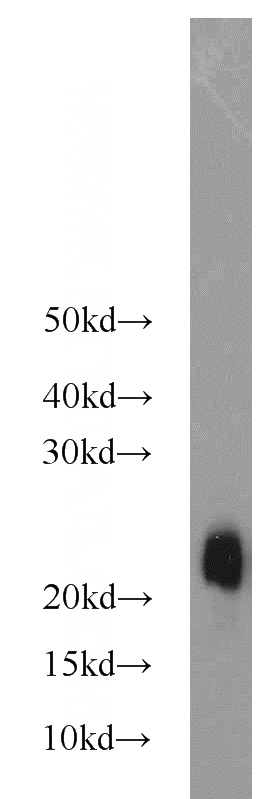 human brain tissue were subjected to SDS PAGE followed by western blot with Catalog No:115727(STMN3 antibody) at dilution of 1:2000