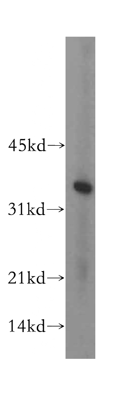 mouse heart tissue were subjected to SDS PAGE followed by western blot with Catalog No:111340(HIBADH antibody) at dilution of 1:400