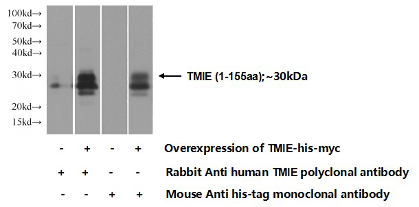 Transfected HEK-293 cells were subjected to SDS PAGE followed by western blot with Catalog No:116204(TMIE Antibody) at dilution of 1:1000