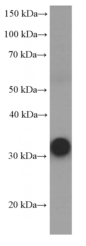 human skeletal muscle tissue were subjected to SDS PAGE followed by western blot with Catalog No:107513(RSPO3 Antibody) at dilution of 1:2000