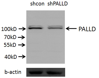 A549 cells (shcontrol and shRNA of PALLD) were subjected to SDS PAGE followed by western blot with Catalog No:113503 (PALLD antibody) at dilution of 1:2000. (Data provided by Angran Biotech (www.miRNAlab.com)).