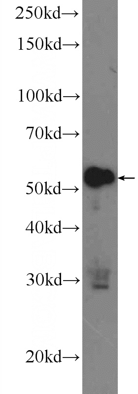 Raji cells were subjected to SDS PAGE followed by western blot with Catalog No:116924(ZC3H12D Antibody) at dilution of 1:600
