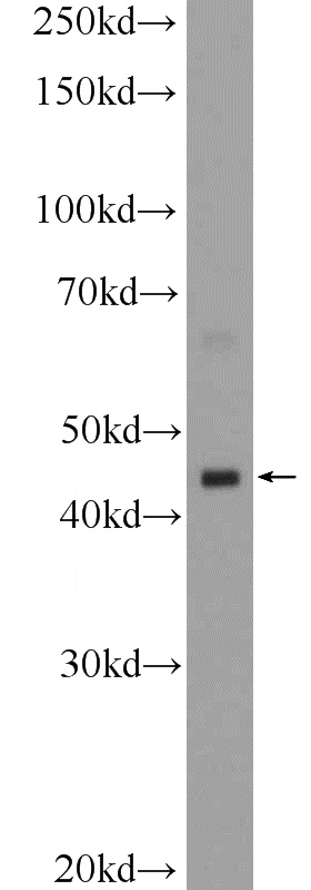 human testis tissue were subjected to SDS PAGE followed by western blot with Catalog No:111562(HSFY1 Antibody) at dilution of 1:1000