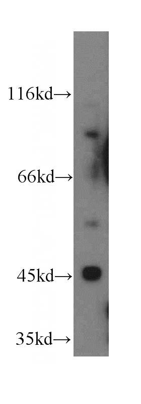 mouse brain tissue were subjected to SDS PAGE followed by western blot with Catalog No:116315(TRIM39 antibody) at dilution of 1:300
