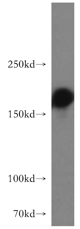 L02 cells were subjected to SDS PAGE followed by western blot with Catalog No:111043(GOLGA3 antibody) at dilution of 1:2000