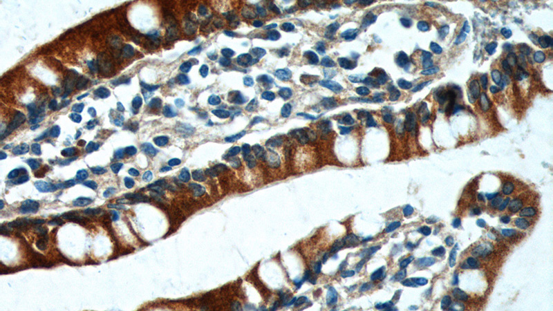 Immunohistochemistry of paraffin-embedded human small intestine tissue slide using Catalog No:113896(PIGR Antibody) at dilution of 1:200 (under 40x lens).