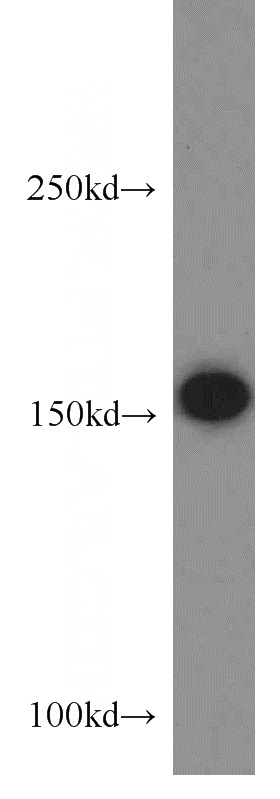HEK-293 cells were subjected to SDS PAGE followed by western blot with Catalog No:112869(MSH6 antibody) at dilution of 1:500