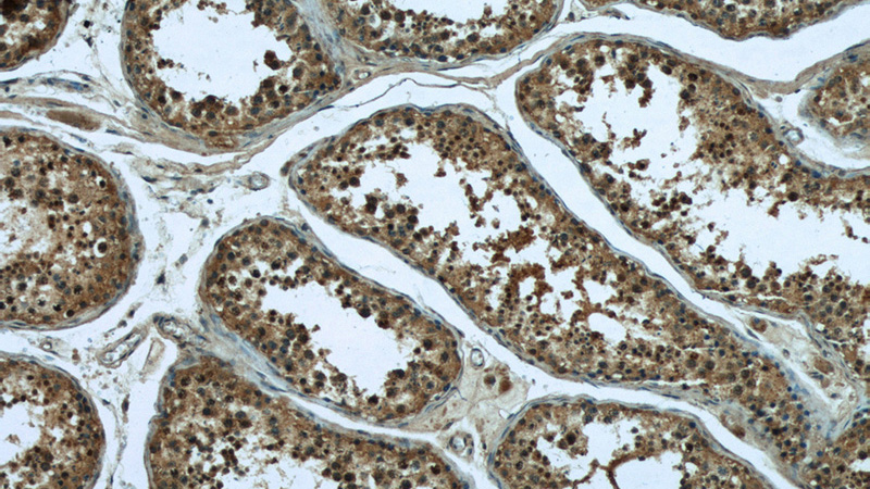 Immunohistochemical of paraffin-embedded human testis using Catalog No:116626(UPF3A antibody) at dilution of 1:50 (under 10x lens)