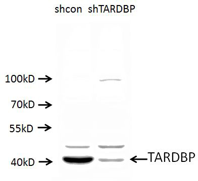 A549 cells (shcontrol and shRNA of TDP43) were subjected to SDS PAGE followed by western blot with Catalog No:115925 (TARDBP antibody) at dilution of 1:1000. (Data provided by Angran Biotech (www.miRNAlab.com)).