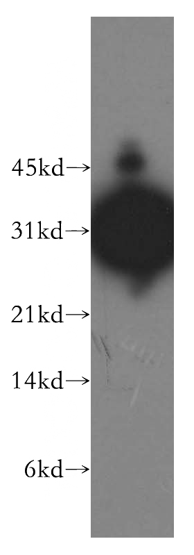 Y79 cells were subjected to SDS PAGE followed by western blot with Catalog No:113519(OTX2 antibody) at dilution of 1:500