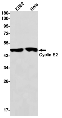 Western blot detection of Cyclin E2 in K562,Hela cell lysates using Cyclin E2 Rabbit mAb(1:1000 diluted).Predicted band size:47kDa.Observed band size:47kDa.