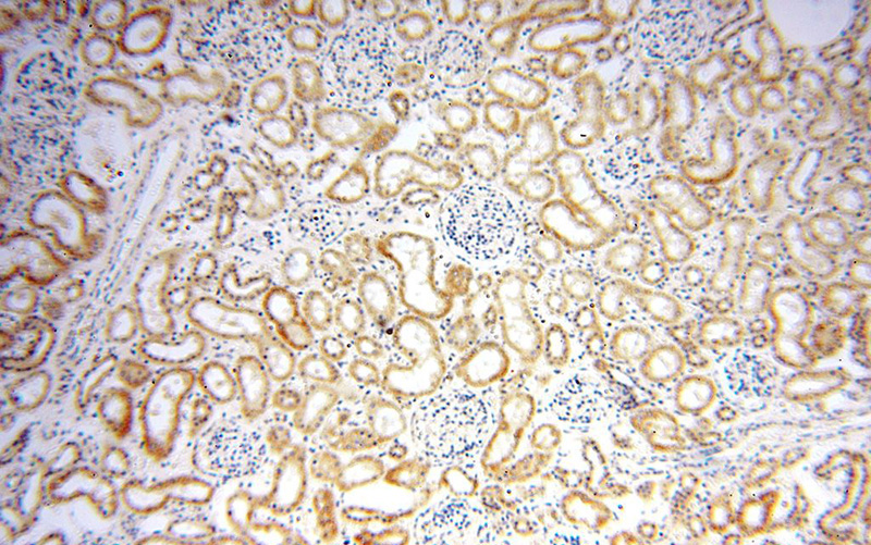 Immunohistochemical of paraffin-embedded human kidney using Catalog No:115063(SAPS3 antibody) at dilution of 1:100 (under 10x lens)