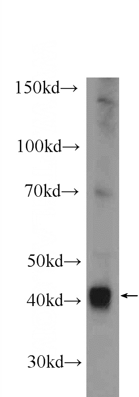 mouse liver tissue were subjected to SDS PAGE followed by western blot with Catalog No:107786(ADH1B Antibody) at dilution of 1:1000