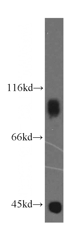 HeLa cells were subjected to SDS PAGE followed by western blot with Catalog No:114547(RAP1GAP antibody) at dilution of 1:2000