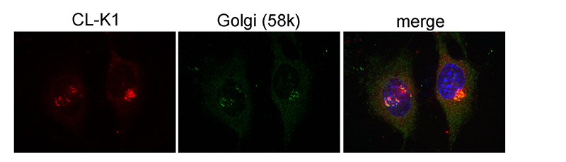 IF result(confocal image) of CL-K1 in ATCD5 cell show Golgi localization from Prof. Philip L. Beales.