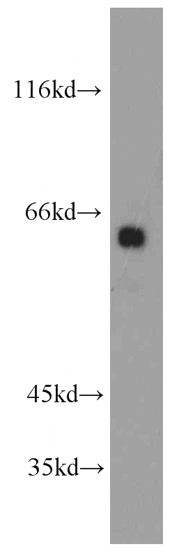 human brain tissue were subjected to SDS PAGE followed by western blot with Catalog No:110793(FKTN antibody) at dilution of 1:1000