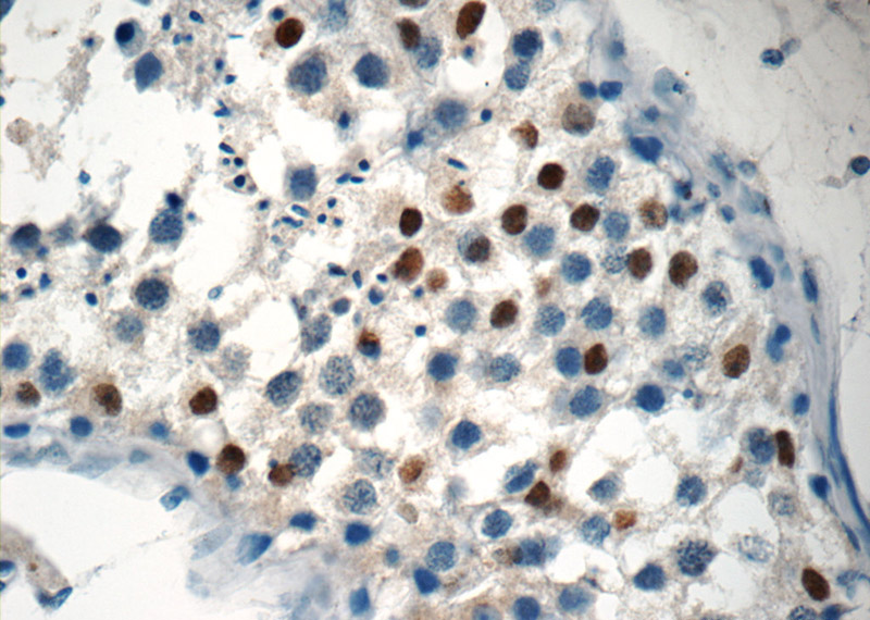 Immunohistochemistry of paraffin-embedded human testis tissue slide using Catalog No:113284(NSBP1 Antibody) at dilution of 1:200 (under 40x lens)