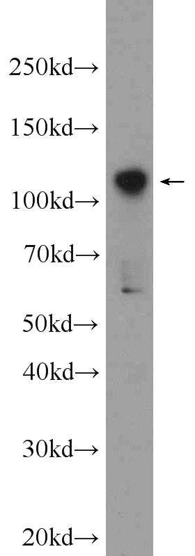 Jurkat cells were subjected to SDS PAGE followed by western blot with Catalog No:117026(ZNF711 Antibody) at dilution of 1:300