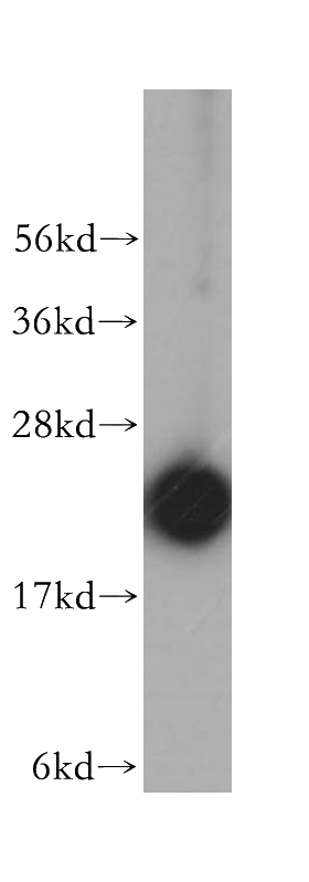 HepG2 cells were subjected to SDS PAGE followed by western blot with Catalog No:114874(RPL18A antibody) at dilution of 1:400