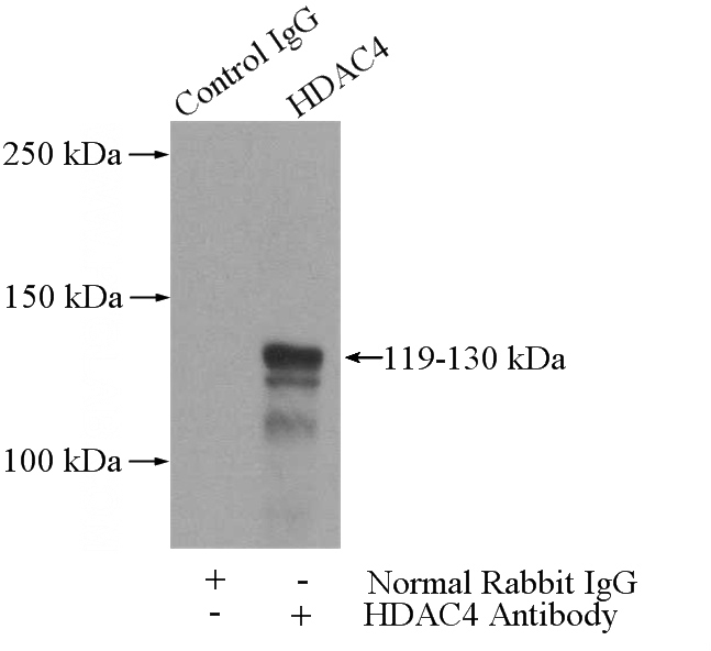 IP Result of anti-HDAC4-specific (IP:Catalog No:111378, 4ug; Detection:Catalog No:111378 1:500) with HeLa cells lysate 2440ug.