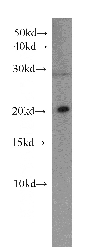 A549 cells were subjected to SDS PAGE followed by western blot with Catalog No:107499(RBBP9 antibody) at dilution of 1:500