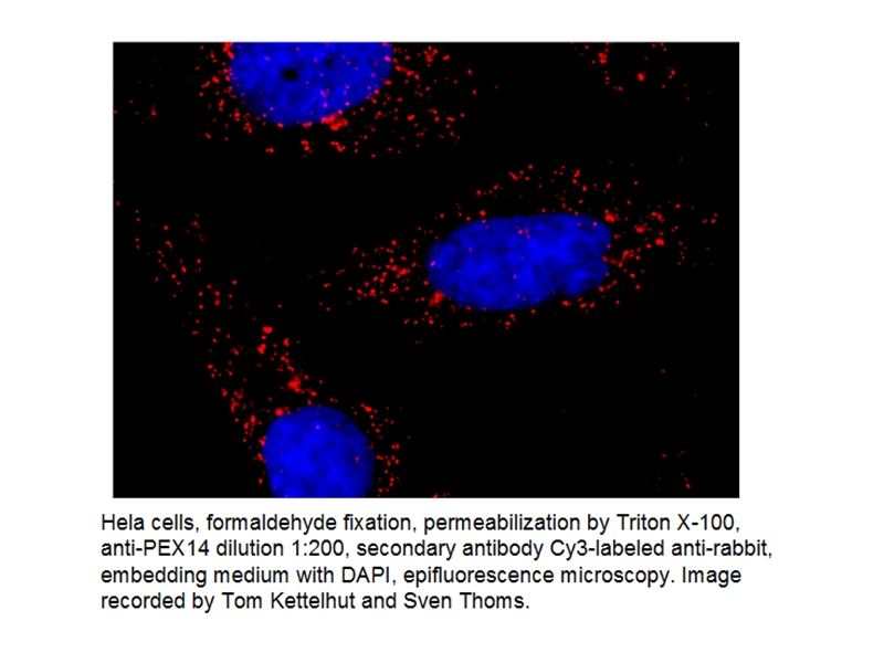 IF result of anti-PEX14 (Catalog No:113727) in Hela cell by Dr. Sven Thoms. Peroxisome Red,Nuclear Blue.