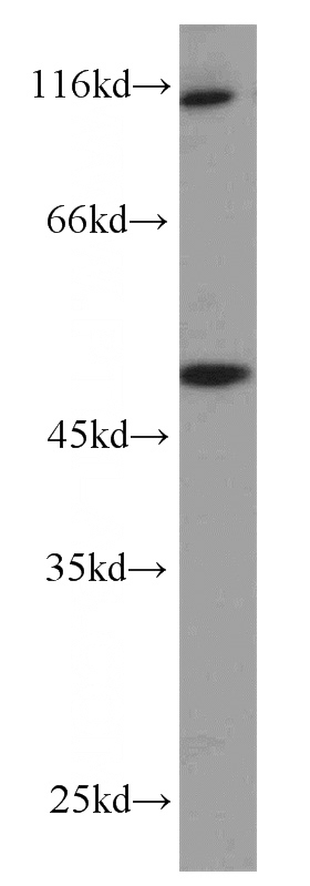 mouse ovary tissue were subjected to SDS PAGE followed by western blot with Catalog No:117157(ZNF3 antibody) at dilution of 1:1000
