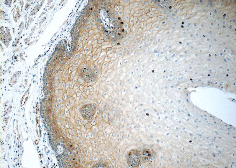 Immunohistochemistry of paraffin-embedded human oesophagus tissue slide using Catalog No:109898(DSC2 Antibody) at dilution of 1:50 (under 10x lens)