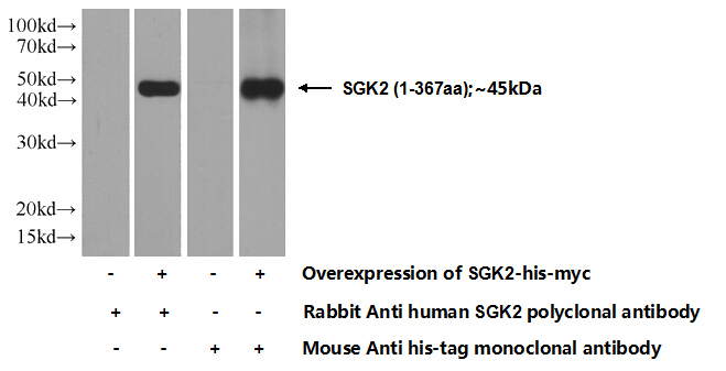 Transfected HEK-293 cells were subjected to SDS PAGE followed by western blot with Catalog No:115167(SGK2 Antibody) at dilution of 1:1000