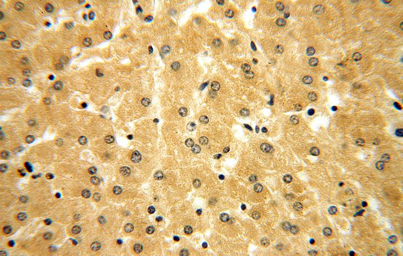 Immunohistochemical of paraffin-embedded human liver using Catalog No:116044(TXN antibody) at dilution of 1:100 (under 40x lens)