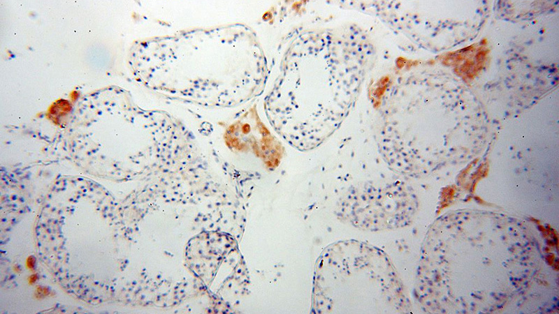 Immunohistochemical of paraffin-embedded human testis using Catalog No:112234(Lin28B-specific antibody) at dilution of 1:50 (under 10x lens)