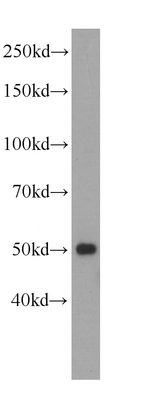K-562 cells were subjected to SDS PAGE followed by western blot with Catalog No:107452(PAX1-Specific Antibody) at dilution of 1:1000
