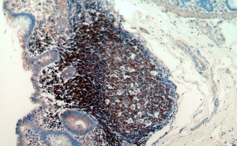 Immunohistochemical of paraffin-embedded human colon using Catalog No:110912(GCNT2 antibody) at dilution of 1:50 (under 10x lens)