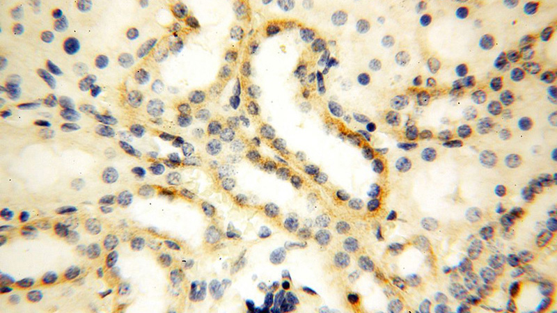 Immunohistochemical of paraffin-embedded human kidney using Catalog No:112834(MRPL52 antibody) at dilution of 1:50 (under 40x lens)