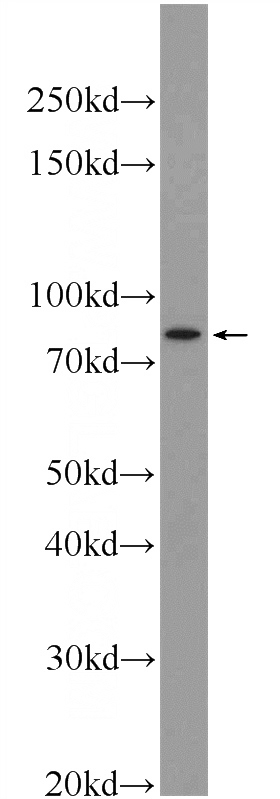 RAW 264.7 cells were subjected to SDS PAGE followed by western blot with Catalog No:114732(RNASEL Antibody) at dilution of 1:600