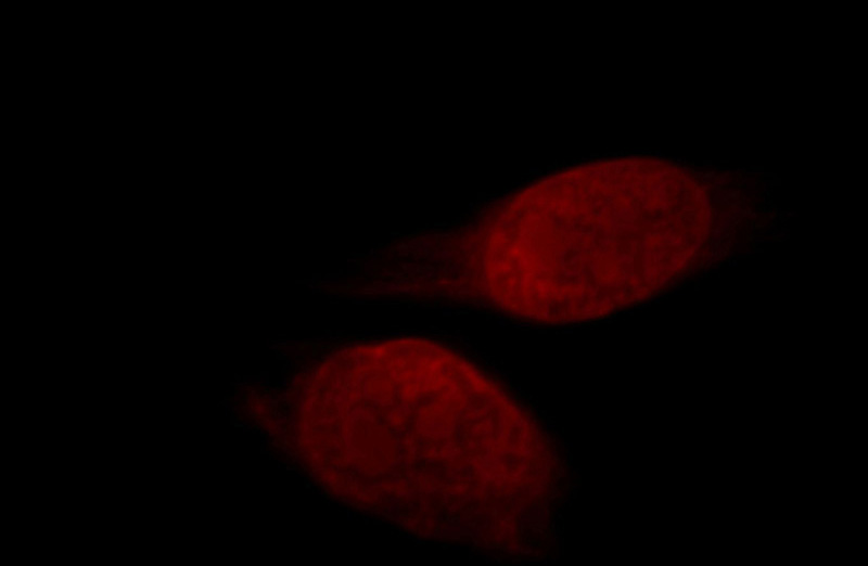 Immunofluorescent analysis of Hela cells, using RBM15 antibody Catalog No: at 1:25 dilution and Rhodamine-labeled goat anti-mouse IgG (red).
