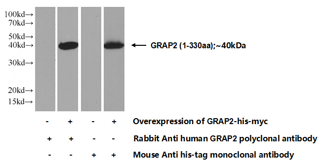 Transfected HEK-293 cells were subjected to SDS PAGE followed by western blot with Catalog No:111162(GRAP2 Antibody) at dilution of 1:1000