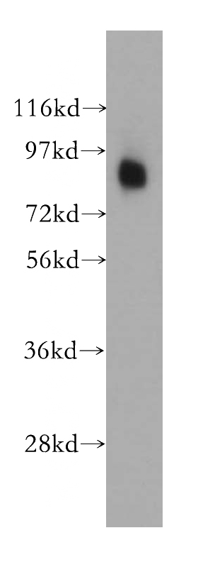 PC-3 cells were subjected to SDS PAGE followed by western blot with Catalog No:115104(SEMA4A antibody) at dilution of 1:400