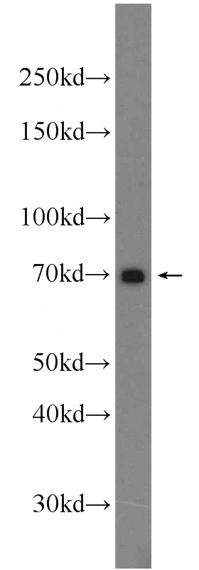HepG2 cells were subjected to SDS PAGE followed by western blot with Catalog No:116323(TRIM67 Antibody) at dilution of 1:600