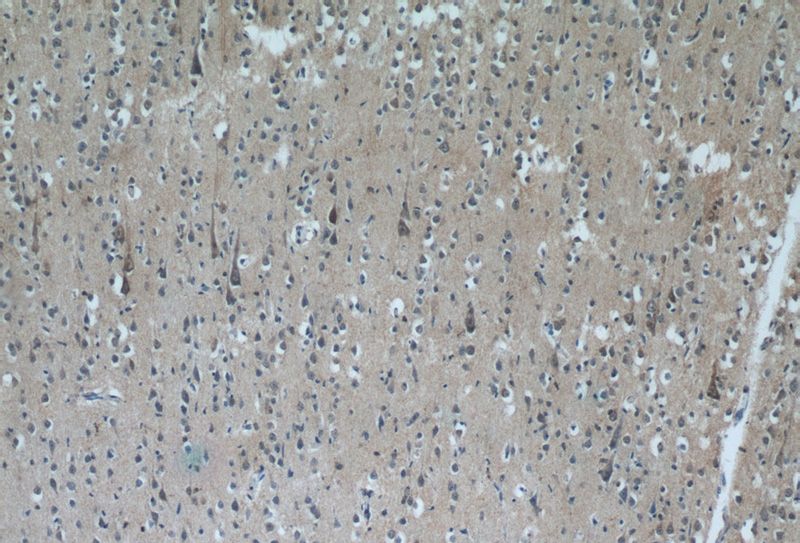 Immunohistochemistry of paraffin-embedded human brain tissue slide using Catalog No:114104(PPP2R3C Antibody) at dilution of 1:50 (under 10x lens)