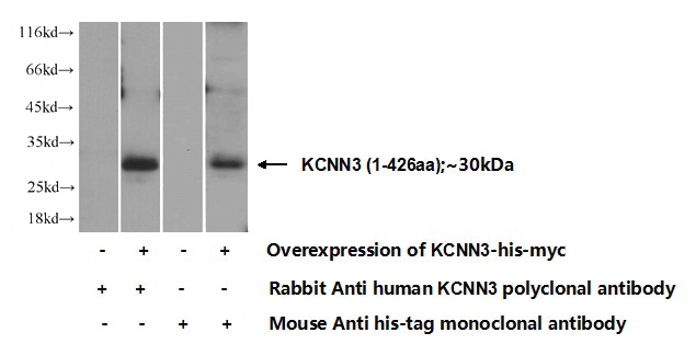Transfected HEK-293 cells were subjected to SDS PAGE followed by western blot with Catalog No:111976(KCNN3 Antibody) at dilution of 1:350