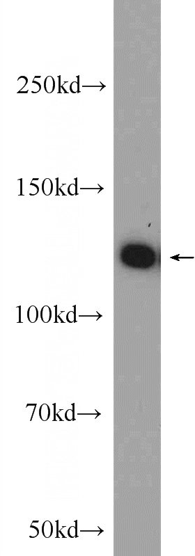 mouse testis tissue were subjected to SDS PAGE followed by western blot with Catalog No:108697(C20orf194 Antibody) at dilution of 1:1000