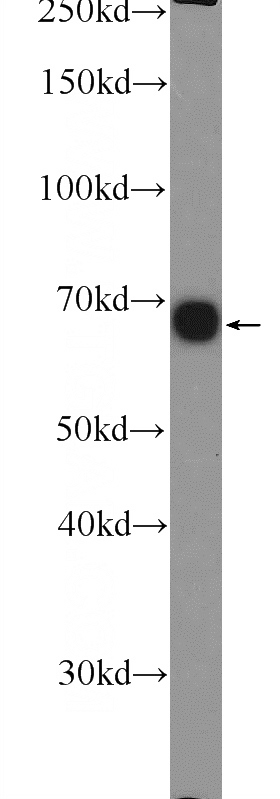 HepG2 cells were subjected to SDS PAGE followed by western blot with Catalog No:111007(GNPAT Antibody) at dilution of 1:600